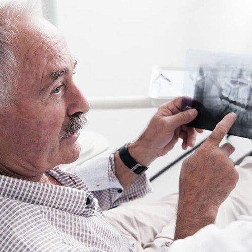 Elderly patient pointing at his x-rays while speaking to doctor 