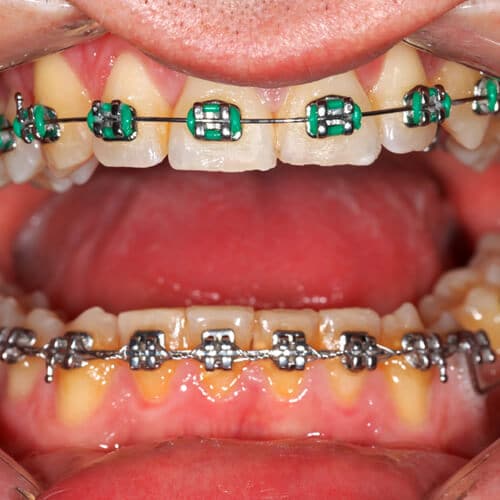 picture-dental-brace-examination-clinic